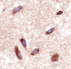Human VIPR2 Antibody, R D Systems 25&mu;g; Unlabeled:Antibodies, Monoclonal