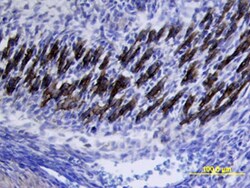 Mouse VLDLR Antibody, R D Systems 100&mu;g; Unlabeled:Antibodies, Polyclonal