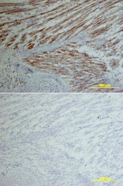 Mouse VLDLR Antibody, R D Systems 100&mu;g; Unlabeled:Antibodies, Polyclonal