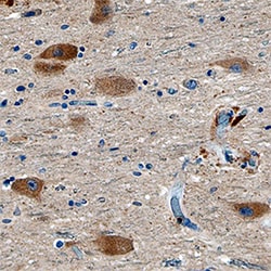 Human VMAT2 Antibody, R D Systems 100ug; Unlabeled:Antibodies, Monoclonal