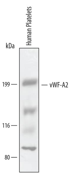 Human vWF-A2 Antibody, R D Systems 25&mu;g; Unlabeled:Antibodies, Polyclonal