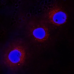 Human/Mouse WASP Antibody, R D Systems 25&mu;g; Unlabeled:Antibodies, Polyclonal
