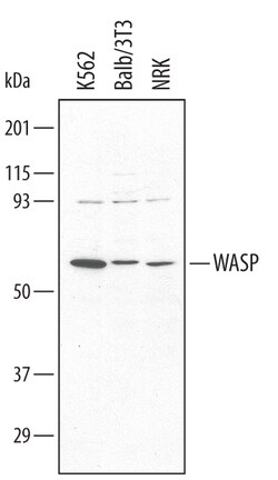Human/Mouse WASP Antibody, R D Systems 25&mu;g; Unlabeled:Antibodies, Polyclonal