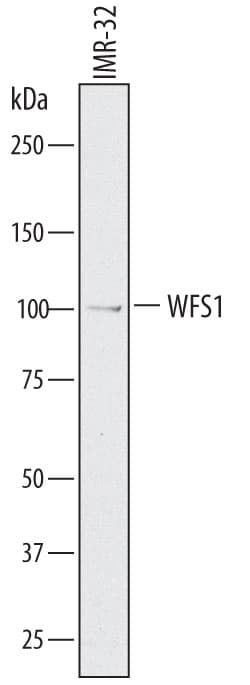 Human WFS1 Antibody, R D Systems 25&mu;g; Unlabeled:Antibodies, Polyclonal
