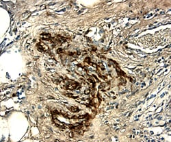 Human WISP-1/CCN4 Antibody, R D Systems 25&mu;g; Unlabeled:Antibodies,