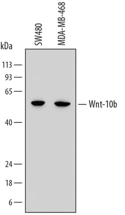 Human Wnt-10b Antibody, R D Systems 100 &mu;g | Buy Online | R&D Systems | Fisher Scientific