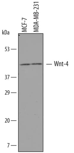 Human Wnt-4 Antibody, R D Systems 100&mu;g; Unlabeled:Antibodies, Polyclonal