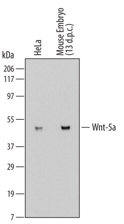 Human/Mouse Wnt-5a Antibody, R D Systems 100ug; Unlabeled:Antibodies, Monoclonal