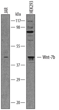 Human Wnt-7b Antibody, R D Systems 25μg; Unlabeled:Antibodies, Polyclonal