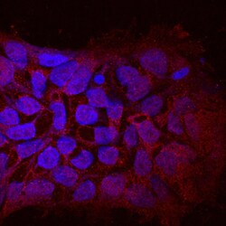 Human WTX Antibody, R D Systems 100ug; Unlabeled:Antibodies, Monoclonal