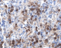 Human/Mouse/Rat XIAP Antibody, R D Systems 25&mu;g; Unlabeled:Antibodies,