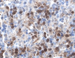 Human/Mouse/Rat XIAP Antibody, R D Systems 100&mu;g; Unlabeled:Antibodies,