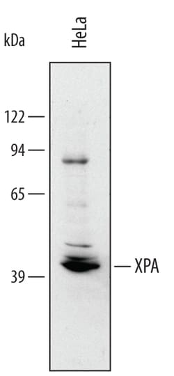 Human XPA Antibody, R D Systems 100&mu;g; Unlabeled:Antibodies, Polyclonal