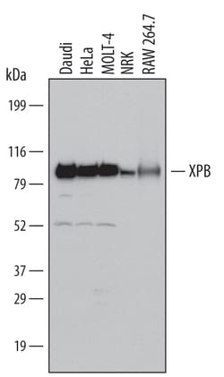 Human/Mouse/Rat XPB Antibody, R D Systems 25&mu;g; Unlabeled:Antibodies,