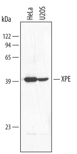 Human XPE/DDB2 Antibody, R D Systems 25&mu;g; Unlabeled:Antibodies, Polyclonal