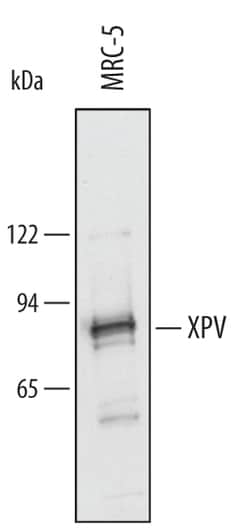Human XPV Antibody, R D Systems 100 &mu;g | Buy Online | R&D Systems | Fisher Scientific