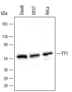 Human YY1 Antibody, R D Systems 25&mu;g; Unlabeled:Antibodies, Polyclonal