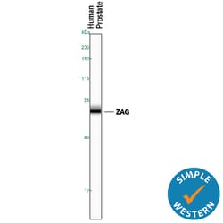 Human ZAG Antibody, R D Systems 100ug; Unlabeled:Antibodies, Monoclonal