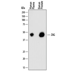 Human ZAG Antibody, R D Systems 100ug; Unlabeled:Antibodies, Monoclonal