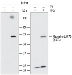 Human Phospho-ZAP70 (Y493) Antibody, R D Systems 100ug; Unlabeled:Antibodies,