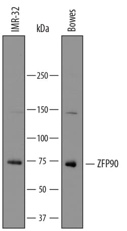 Human ZFP90 Antibody, R D Systems 25&mu;g; Unlabeled:Antibodies, Polyclonal