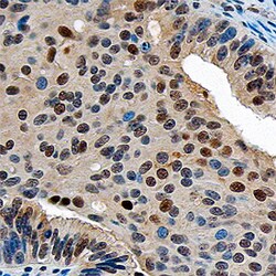 Human ZMIZ1/Zimp10 Antibody, R D Systems 25&mu;g; Unlabeled:Antibodies,