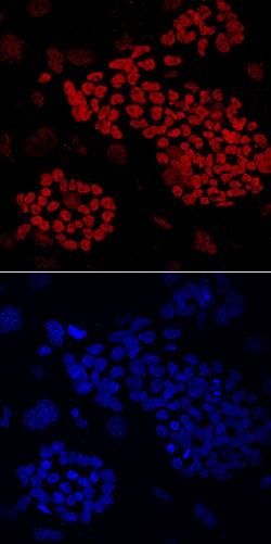 Human ZNF281 Antibody, R D Systems 100ug; Unlabeled:Antibodies, Monoclonal