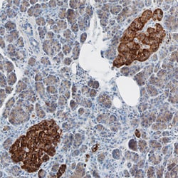 Human ZnT-8 Antibody, R D Systems 100&mu;g; Unlabeled:Antibodies, Polyclonal