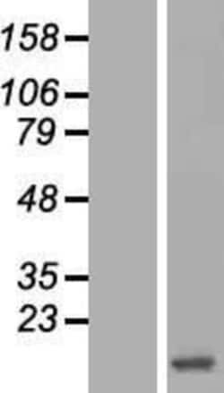 Novus Biologicals&trade;&nbsp;Hemoglobin zeta Overexpression Lysate