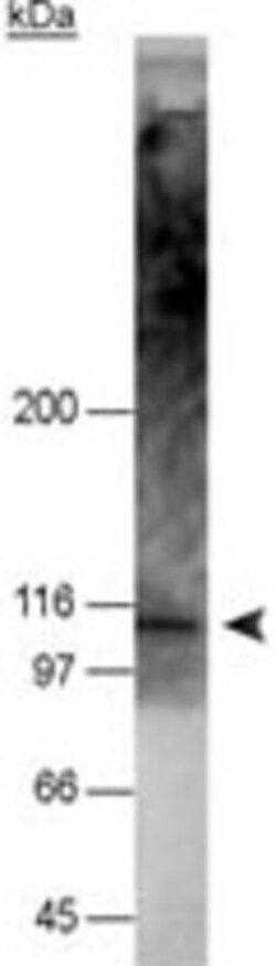 NOD2 Mouse anti-Human, Mouse, Clone: 2D9, Abnova 100 &mu;L | Buy Online | Abnova Corporation | Fisher Scientific