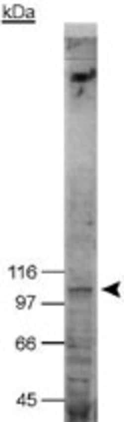 NOD2 Mouse anti-Human, Mouse, Clone: 2D9, Abnova 100 &mu;L | Buy Online | Abnova Corporation | Fisher Scientific