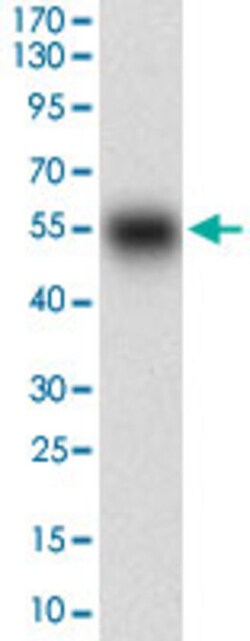 SMCP Mouse anti-Human, Clone: 5C10D8, Abnova 100 &mu;g | Buy Online | Abnova Corporation | Fisher Scientific