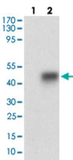 SMCP Mouse anti-Human, Clone: 5C10D8, Abnova 100 &mu;g | Buy Online | Abnova Corporation | Fisher Scientific