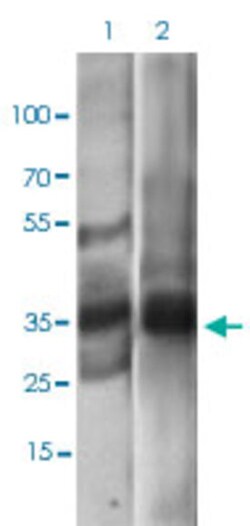EPCAM Mouse anti-Human, Clone: 7B5C10, Abnova 100&mu;g; Unlabeled:Antibodies,