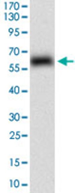 EPCAM Mouse anti-Human, Clone: 7B5C10, Abnova 100&mu;g; Unlabeled:Antibodies,