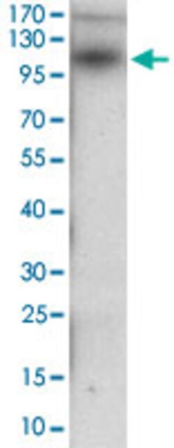 DSG3 Mouse anti-Human, Clone: 6G2C11, Abnova 100&mu;g; Unlabeled:Antibodies,