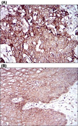 DSG3 Mouse anti-Human, Clone: 6G2C11, Abnova 100&mu;g; Unlabeled:Antibodies,
