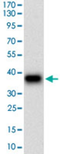 DSG3 Mouse anti-Human, Clone: 6G2C11, Abnova 100&mu;g; Unlabeled:Antibodies,