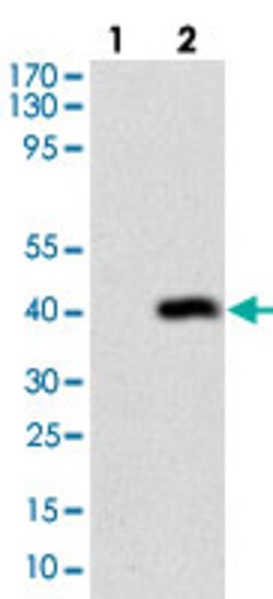 DSG3 Mouse anti-Human, Clone: 6G2C11, Abnova 100&mu;g; Unlabeled:Antibodies,