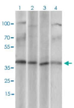 CD68 Mouse anti-Human, Clone: 3F7D3, Abnova 100&mu;g; Unlabeled:Antibodies,