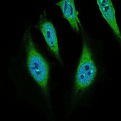 CD68 Mouse anti-Human, Clone: 3F7D3, Abnova 100&mu;g; Unlabeled:Antibodies,