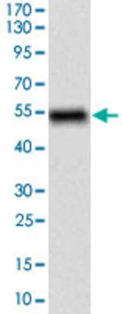 CD68 Mouse anti-Human, Clone: 3F7D3, Abnova 100&mu;g; Unlabeled:Antibodies,