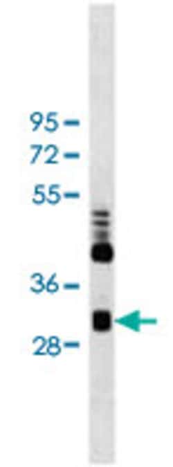 CLIC4 Mouse anti-Human, Clone: 17CT9.2.8, Abnova 100 &mu;L | Buy Online | Abnova Corporation | Fisher Scientific