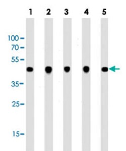 ACTB Mouse anti-Human, Mouse, Rat, Clone: 137CT26.1.1, Abnova 400μL;