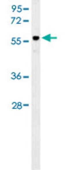 AKT2 Mouse anti-Human, Mouse, Clone: 148CT5.4.1.4, Abnova 400 &mu;L | Buy Online | Abnova | Fisher Scientific