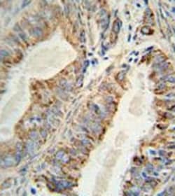 AKT2 Mouse anti-Human, Mouse, Clone: 148CT5.4.1.4, Abnova 400 &mu;L | Buy Online | Abnova | Fisher Scientific