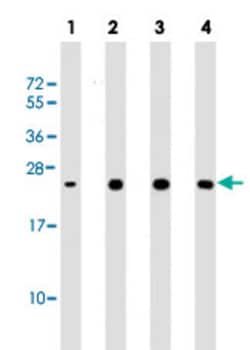 SOD2 Mouse anti-Human, Clone: 37CT127.5.11.6, Abnova 400&mu;L; Unlabeled:Antibodies,