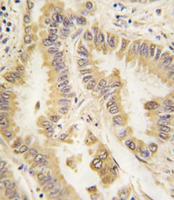 SOD2 Mouse anti-Human, Clone: 37CT127.5.11.6, Abnova 400&mu;L; Unlabeled:Antibodies,