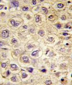 TYRO3 Mouse anti-Human, Clone: 64CT15.6.2.3.1, Abnova 400&mu;L; Unlabeled:Antibodies,