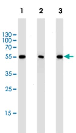 PPARA Mouse anti-Human, Mouse, Clone: 1331CT894.186.143, Abnova 400&mu;L;